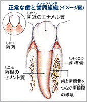 正常な歯と歯周組織(イメージ図)